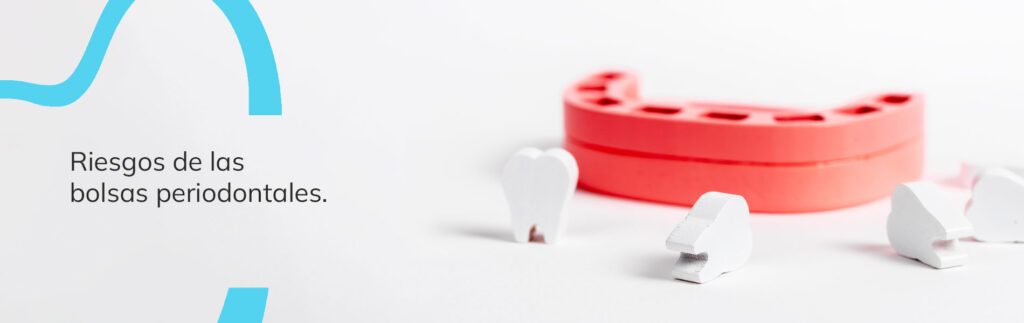 riesgos de las bolsas periodontales